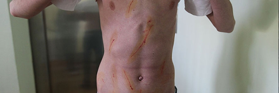 Učenika osmog razreda huligani cipelarili i isjekli skalpelom po trbuhu